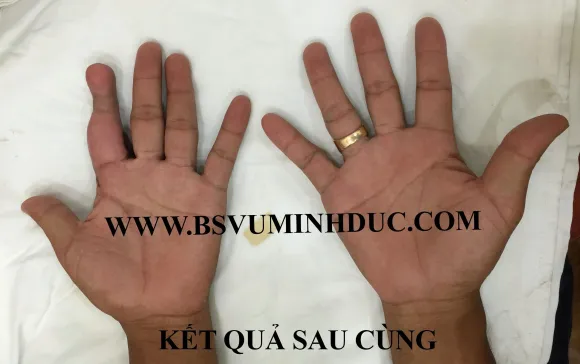 Nối & Tái Tạo Tay Chân