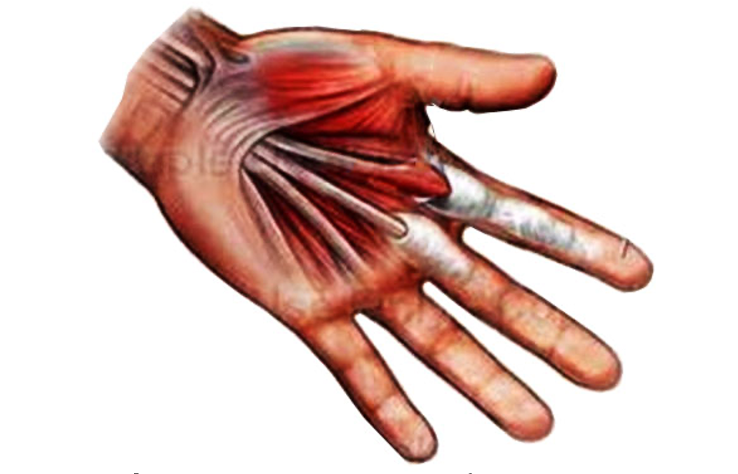 Cấu tr&uacute;c bao g&acirc;n thay đổi trong ng&oacute;n tay bật