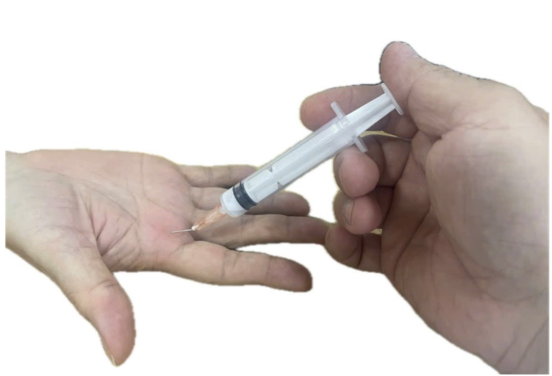 Ch&iacute;ch Steroid điều trị ng&oacute;n tay bật
